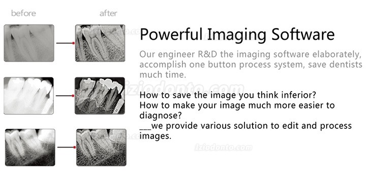 Handy HDR-600 Sensor Para Radiografia Odontológica Sistema de Imagem por Raio-x Intraoral